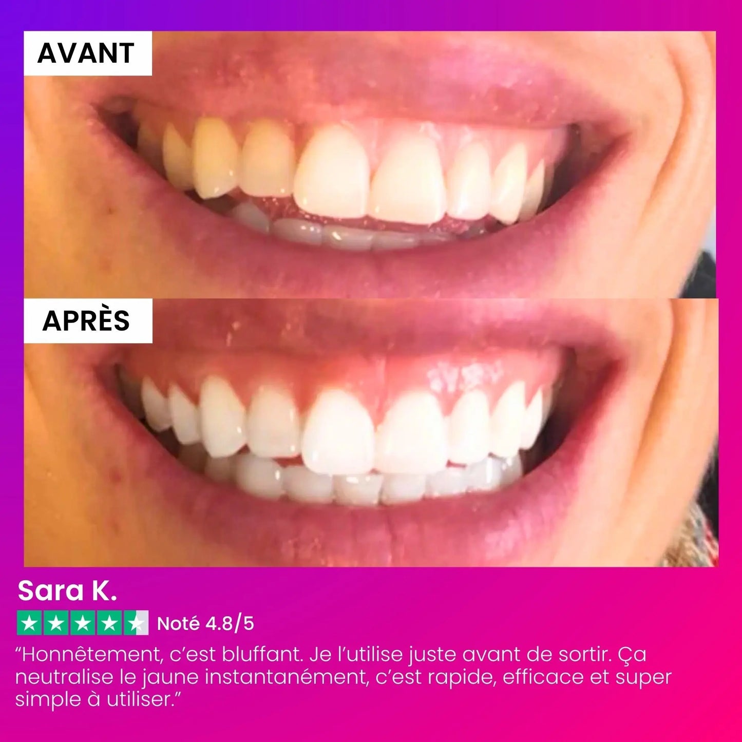 Sérum Blanchissant V34 IVI Smile