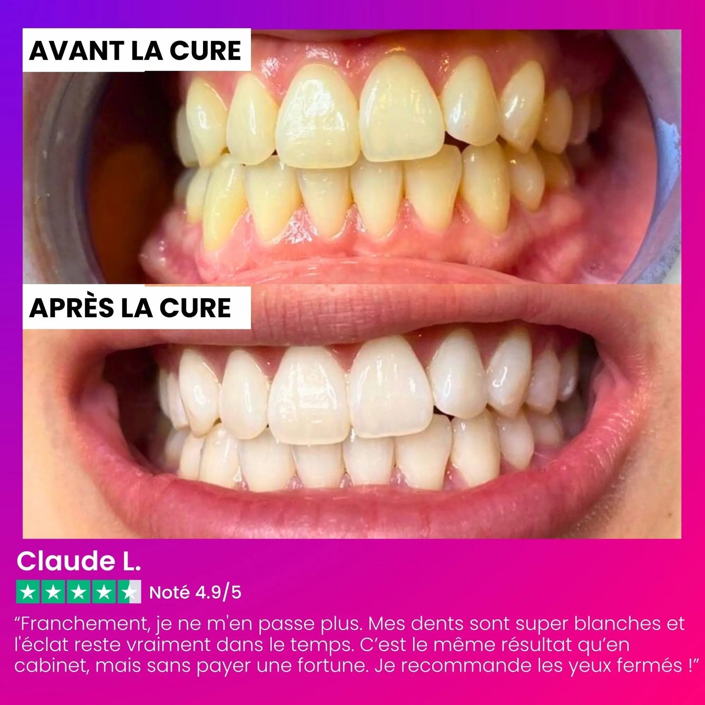 Bandes Blanchissante V34 IVI Smile