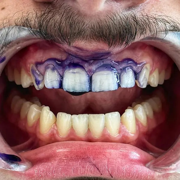 Sérum Blanchissant V34 IVI Smile